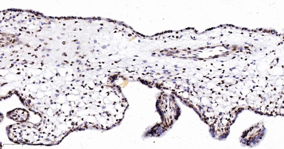 磷酸化细胞信号转导分子SMAD5重组兔单抗