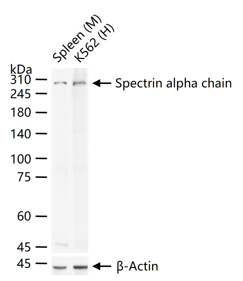 血影蛋白A链红细胞型重组兔单抗