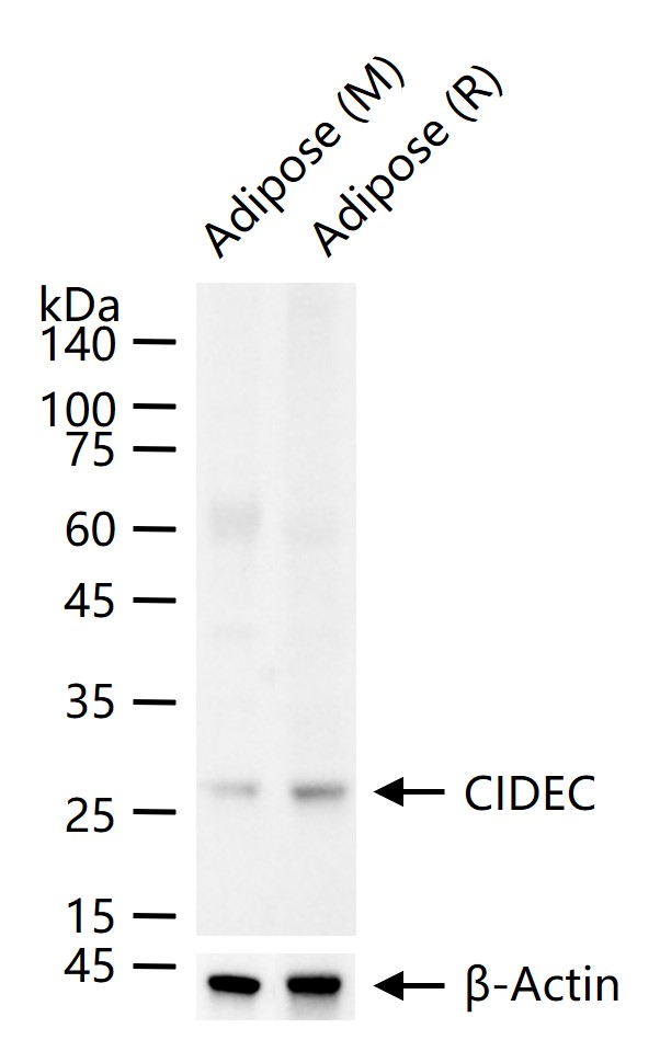 CIDEC Rabbit pAb (一抗) - WB,IHC-P,IHC-F,IF,Flow-Cyt,ICC/IF | Bioss