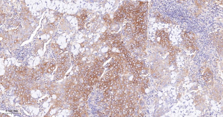 甘氨酰胺核苷酸合成酶重组兔单抗