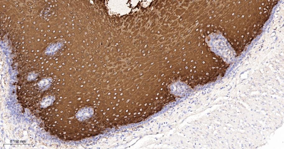 细胞角蛋白4重组兔单抗
