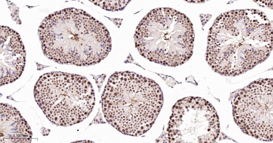 磷酸化细胞信号转导分子SMAD5重组兔单抗