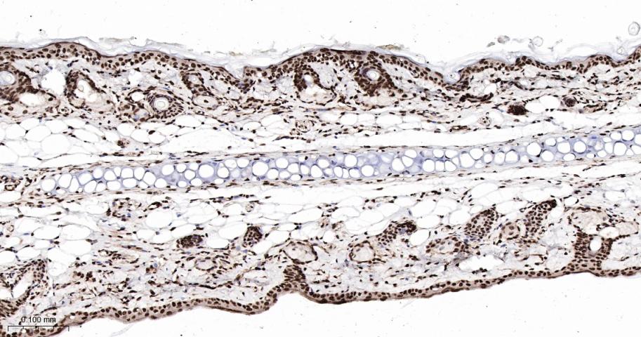 磷酸化细胞信号转导分子SMAD5重组兔单抗