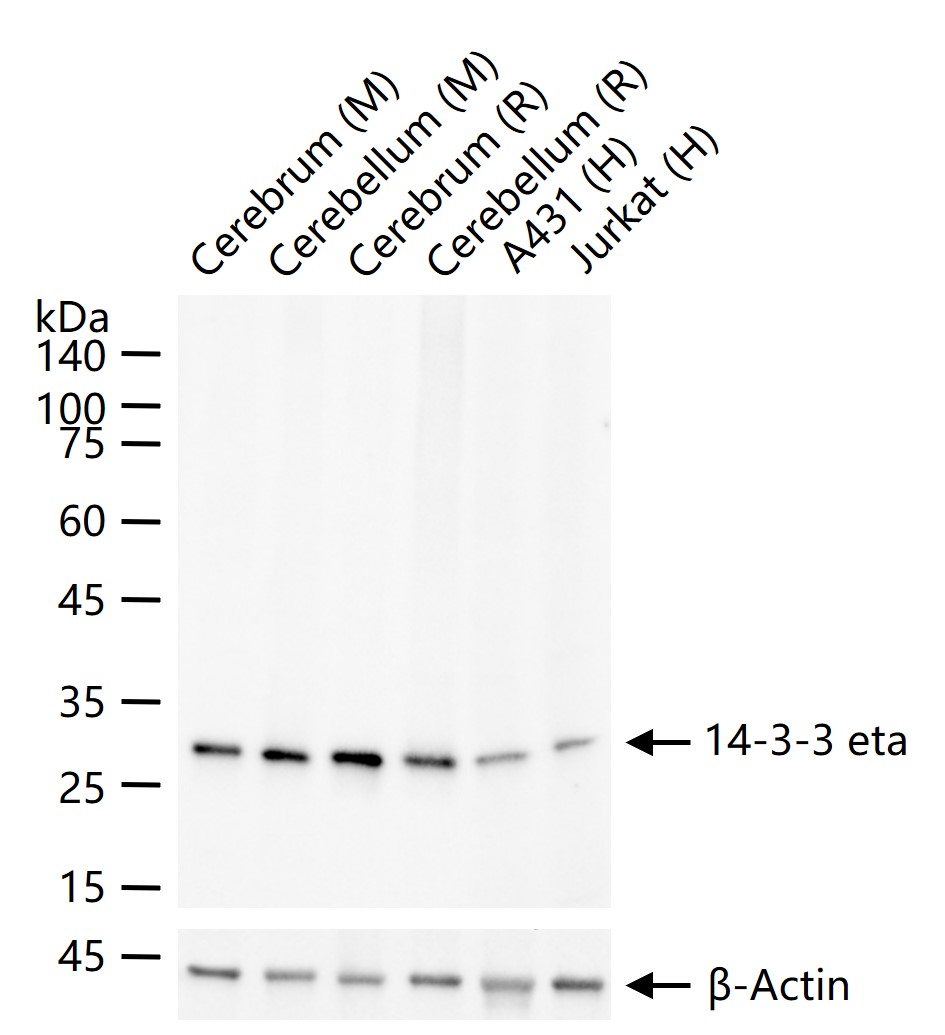 14-3-3 eta重组兔单抗