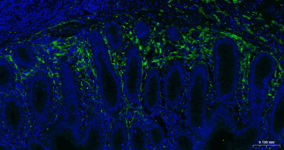 神经细胞粘附分子1重组鼠单抗-bsm-54786M