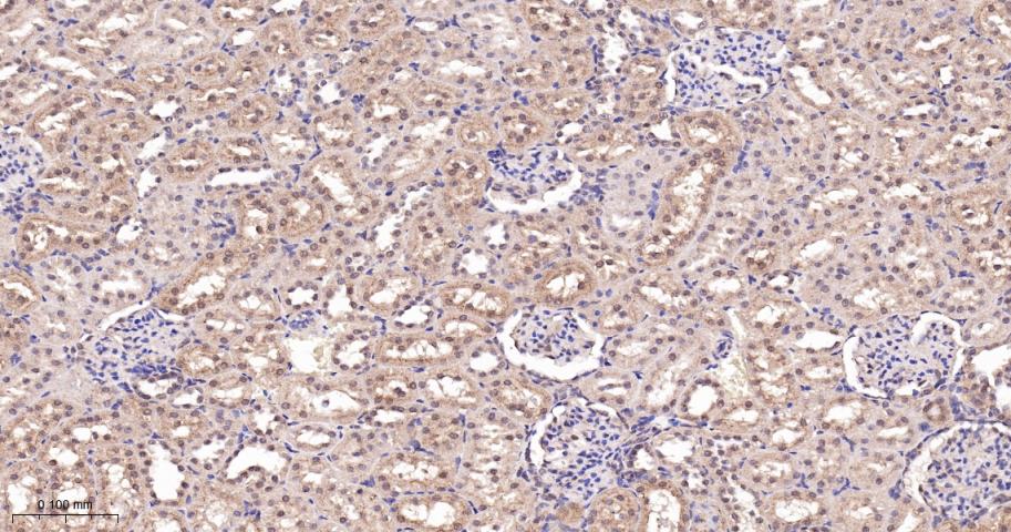 肿瘤易感基因101蛋白抗体