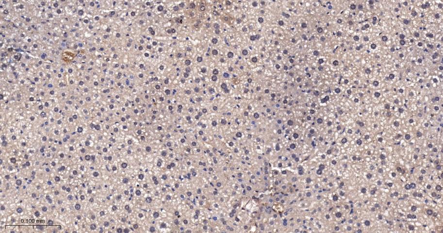 肿瘤易感基因101蛋白抗体