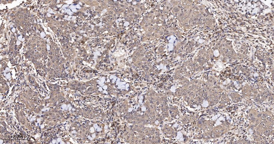 DNA结合抑制因子1重组兔单抗