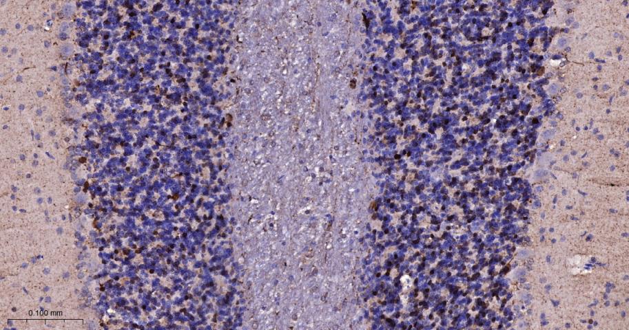 钙结合蛋白重组兔单抗