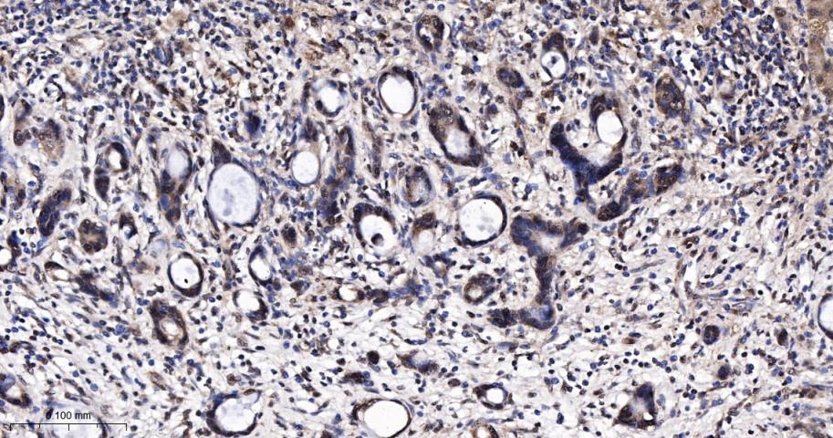 DNA结合抑制因子1重组兔单抗