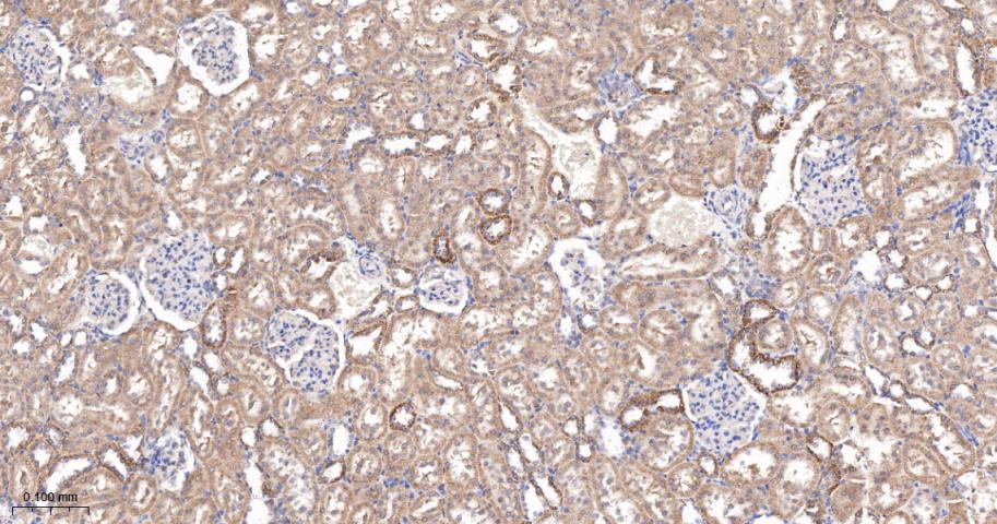 糖皮质激素调节激酶1重组兔单抗