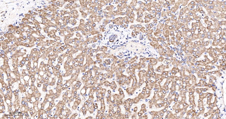 糖皮质激素调节激酶1重组兔单抗