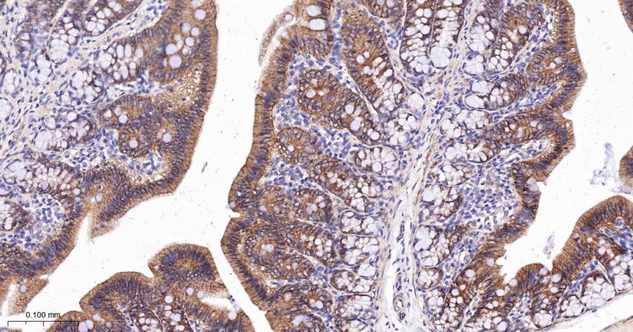 β-连环蛋白/β-连环素/β链接素重组兔单抗