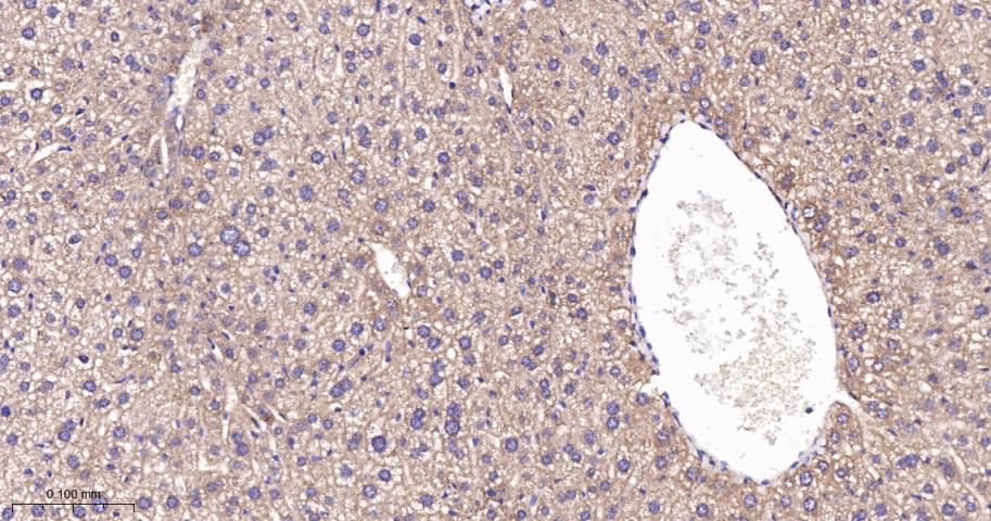 糖皮质激素调节激酶1重组兔单抗