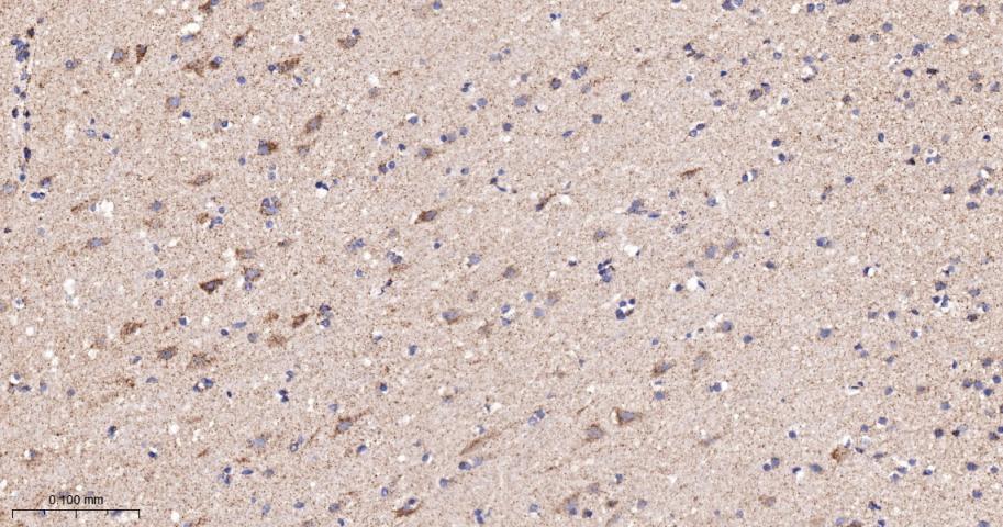 糖皮质激素调节激酶1重组兔单抗