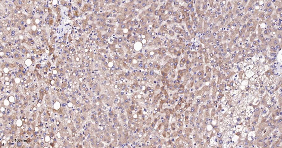 肿瘤易感基因101蛋白抗体