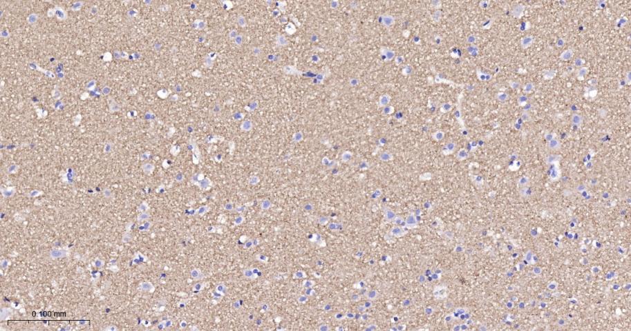 神经突触素2重组兔单抗