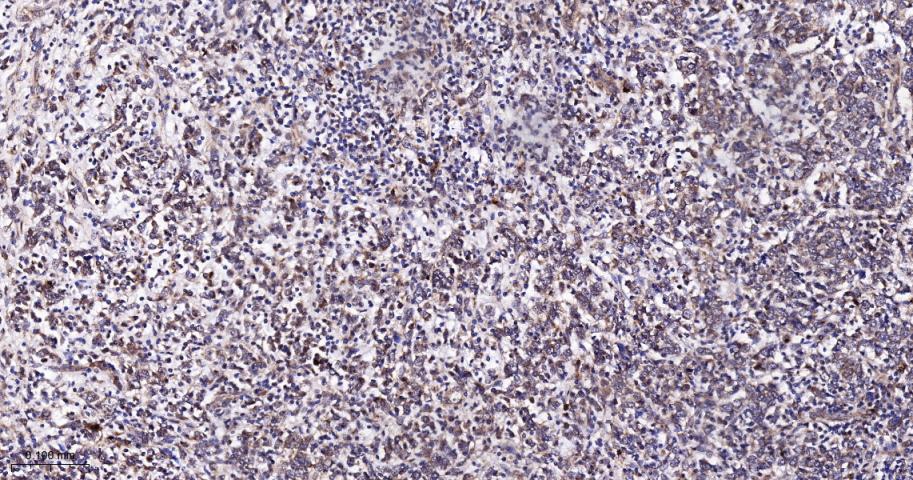 肿瘤易感基因101蛋白抗体