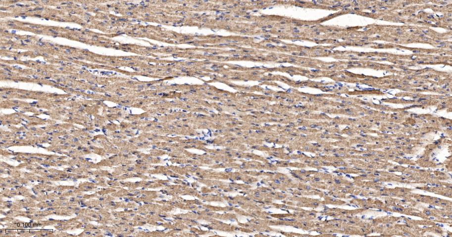 肿瘤易感基因101蛋白抗体