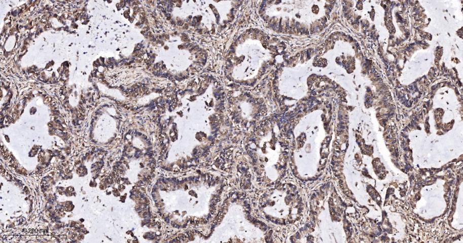 DNA结合抑制因子1重组兔单抗