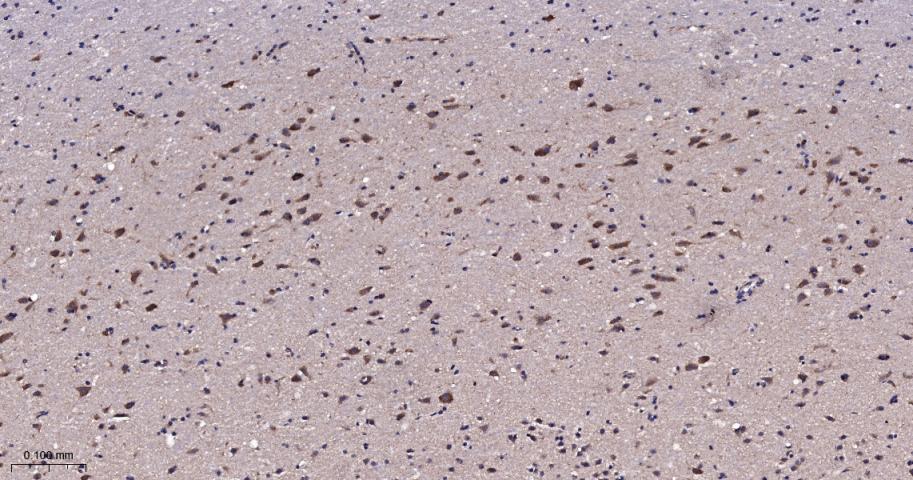 肿瘤易感基因101蛋白抗体