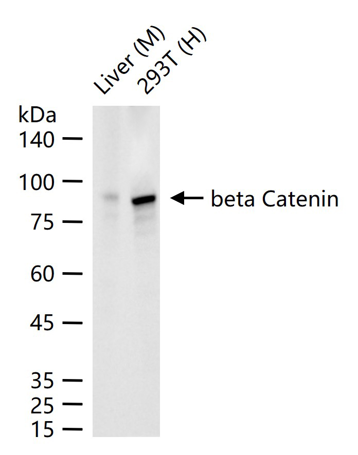 β-连环蛋白/β-连环素/β链接素重组兔单抗