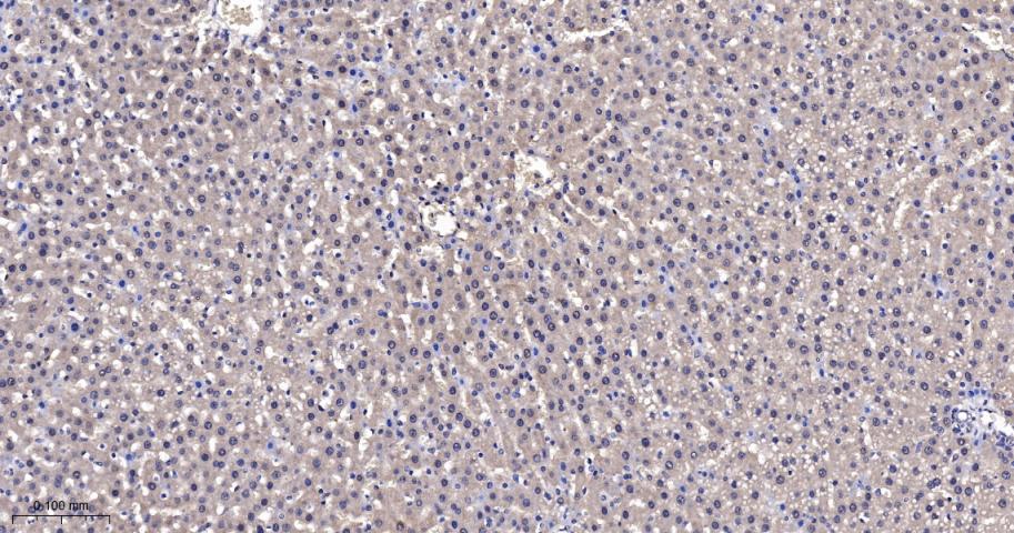肿瘤易感基因101蛋白抗体
