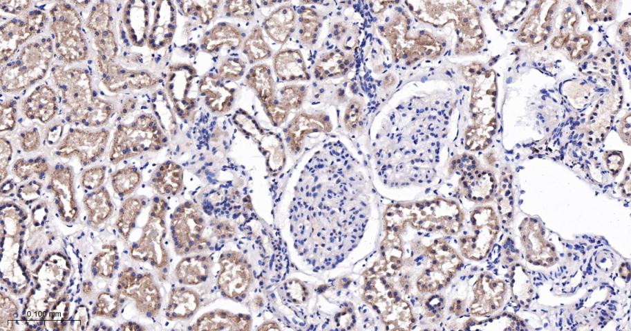 肿瘤易感基因101蛋白抗体