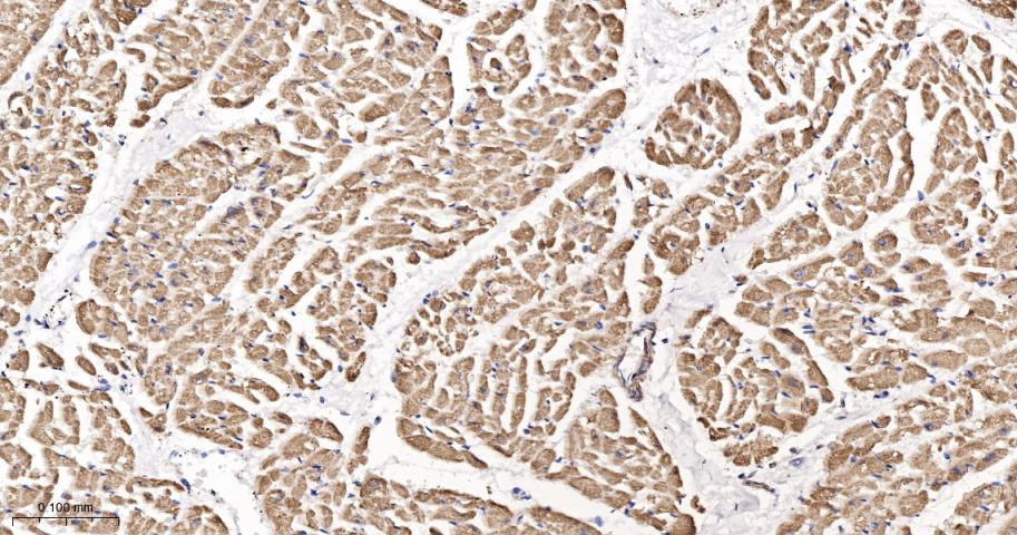 糖皮质激素调节激酶1重组兔单抗