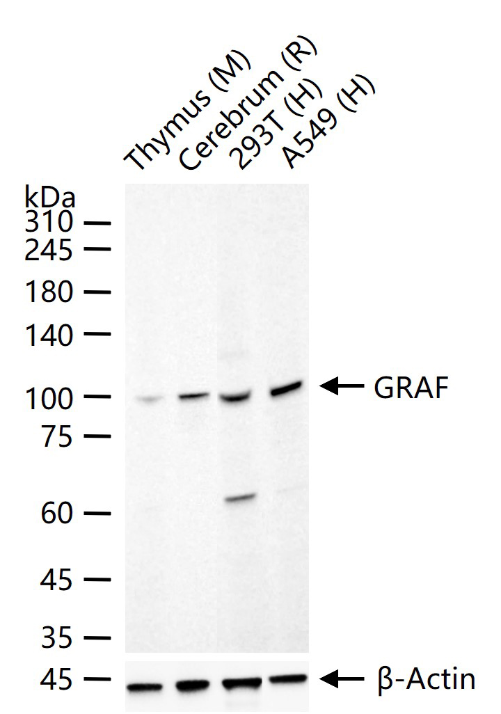 Rho GTP酶激活蛋白26重组兔单抗