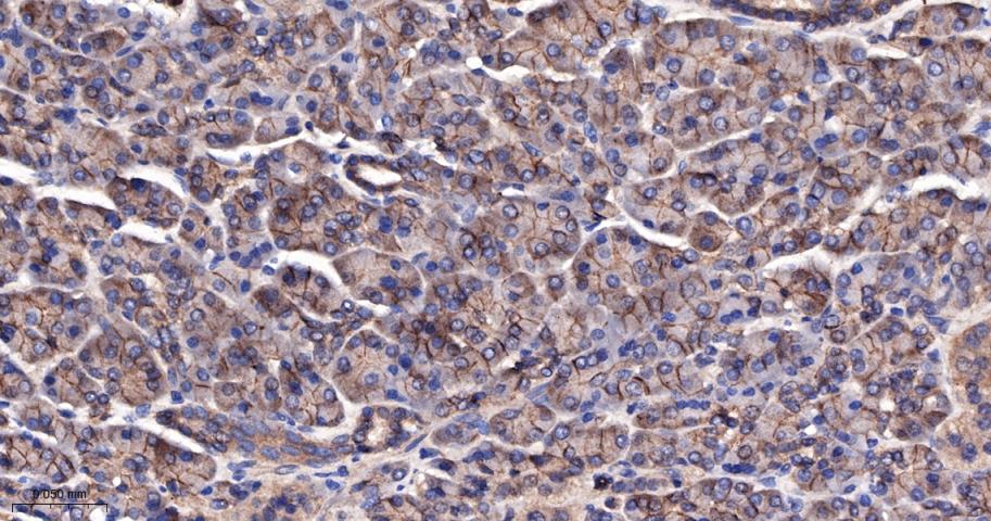 β-连环蛋白/β-连环素/β链接素重组兔单抗