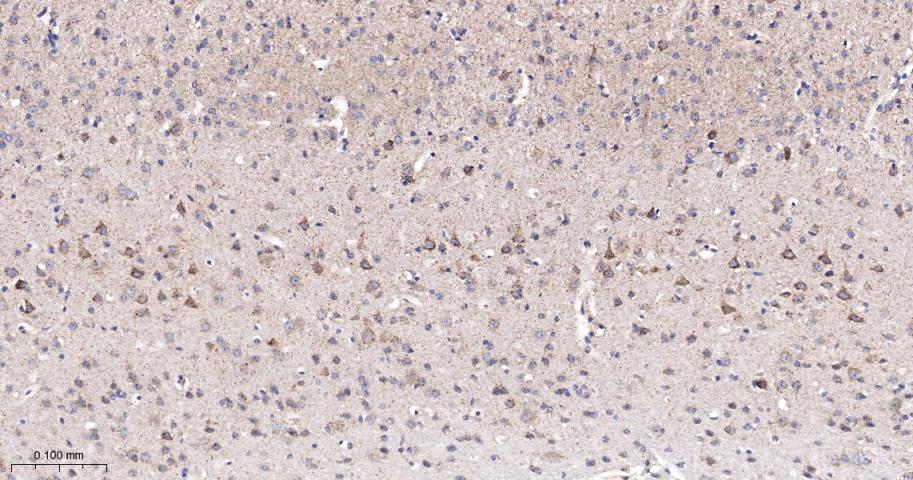 糖皮质激素调节激酶1重组兔单抗