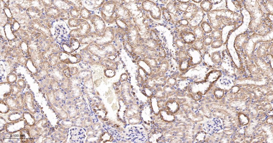 糖皮质激素调节激酶1重组兔单抗