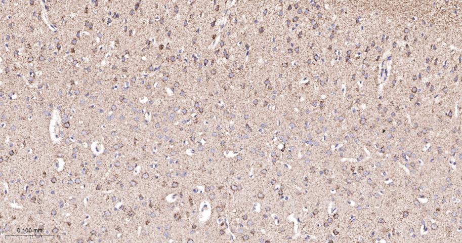 糖皮质激素调节激酶1重组兔单抗