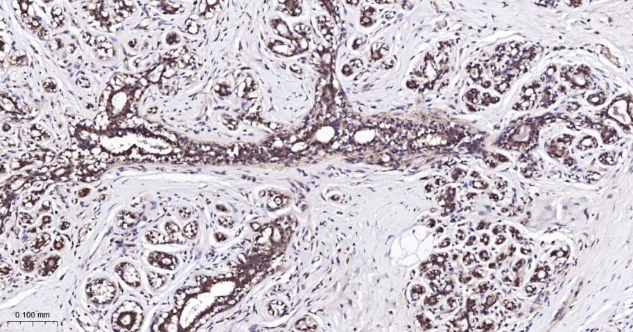 肿瘤易感基因101蛋白抗体