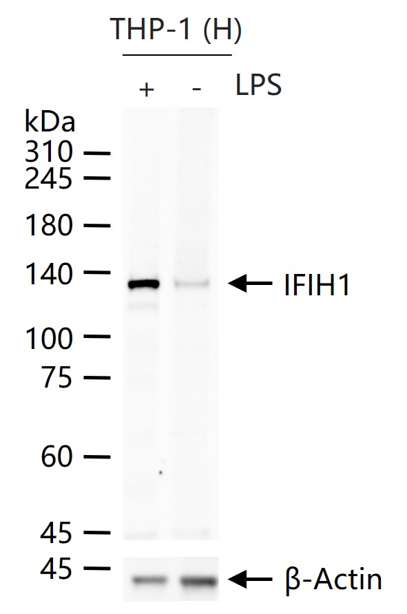 黑色素瘤分化相关蛋白5重组兔单抗