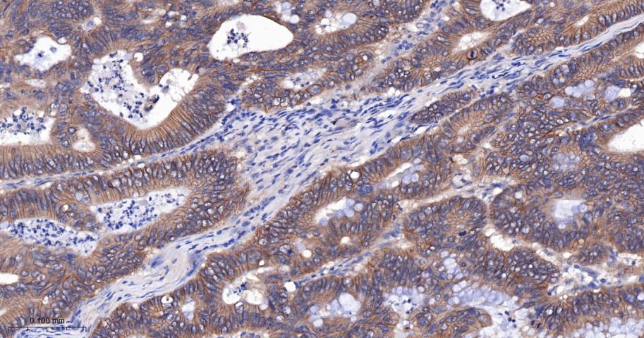 β-连环蛋白/β-连环素/β链接素重组兔单抗
