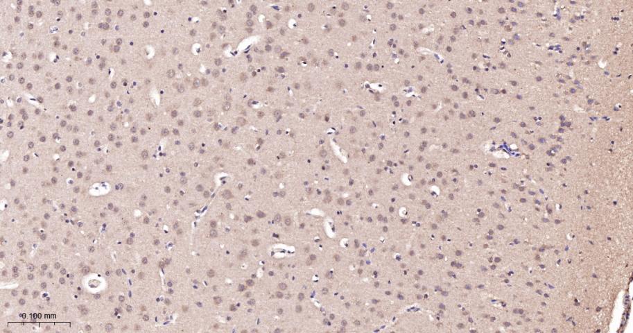 肿瘤易感基因101蛋白抗体