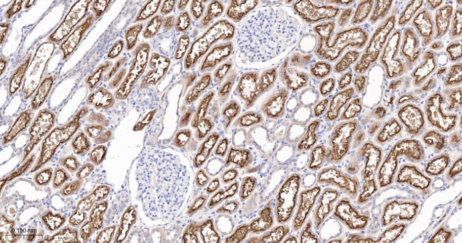 内皮因子维生素B12受体重组兔单抗
