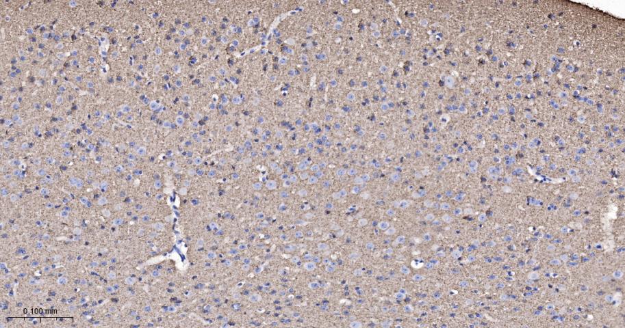 神经突触素2重组兔单抗