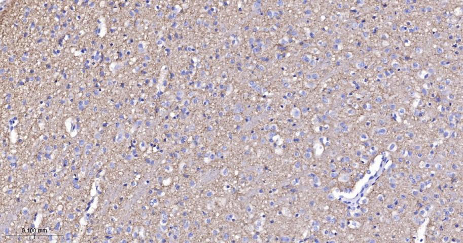 神经突触素2重组兔单抗