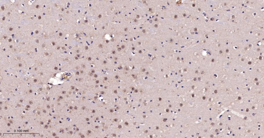 肿瘤易感基因101蛋白抗体