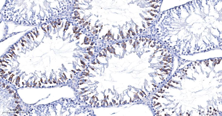 周期素B2重组兔单抗