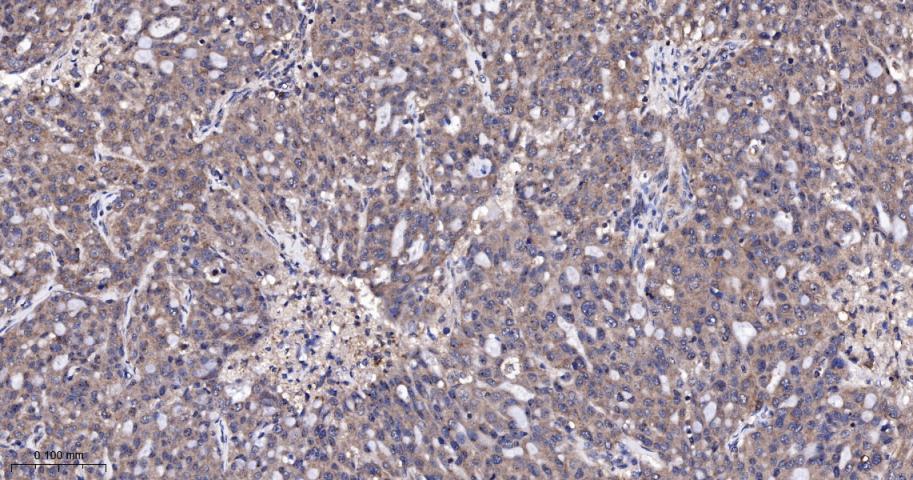 肿瘤易感基因101蛋白抗体
