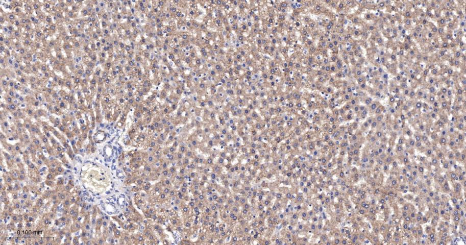 糖皮质激素调节激酶1重组兔单抗