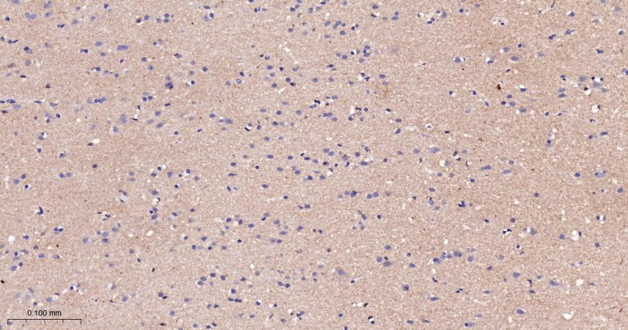 β-连环蛋白/β-连环素/β链接素重组兔单抗