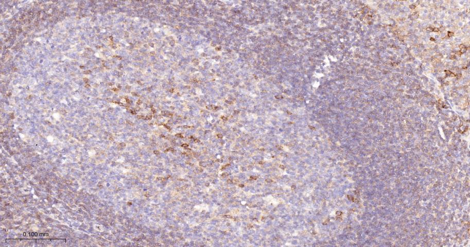 CD46重组兔多克隆抗体