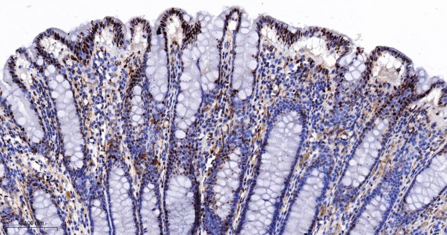 DNA修复酶Ku-80重组兔单抗