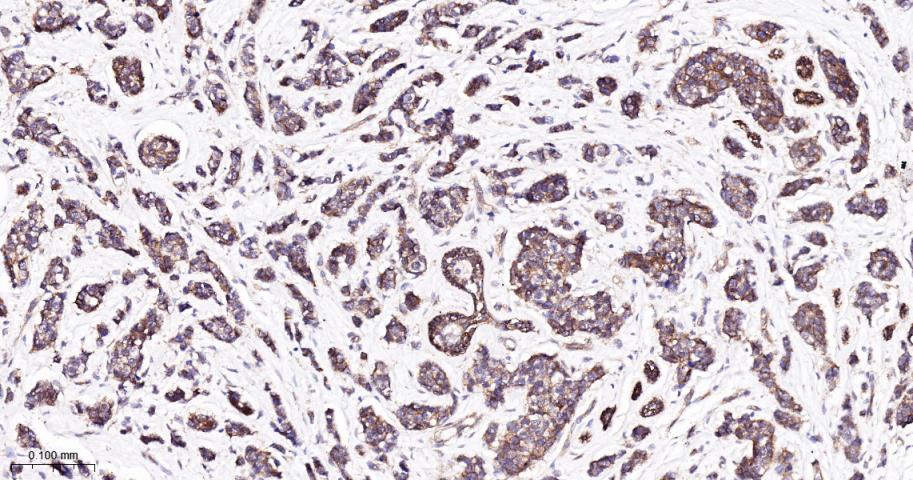 β-连环蛋白/β-连环素/β链接素重组兔单抗