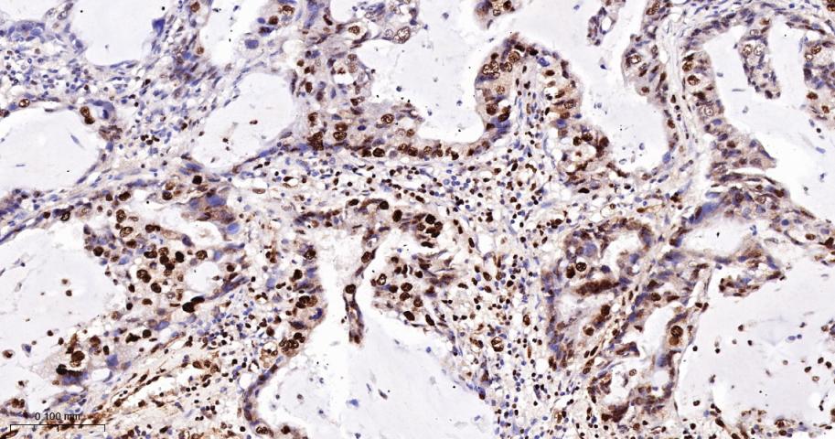 DNA修复酶Ku-80重组兔单抗